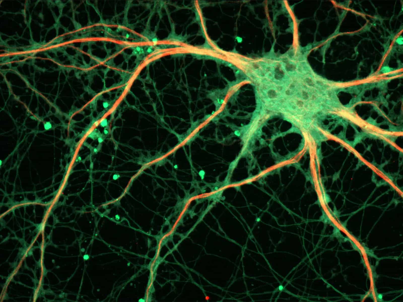 Liberarsi dai brutti ricordi è possibile, grazie alla scienza