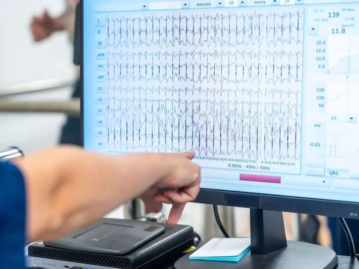 Inquinamento aria, ne basta poco per danneggiare il cuore