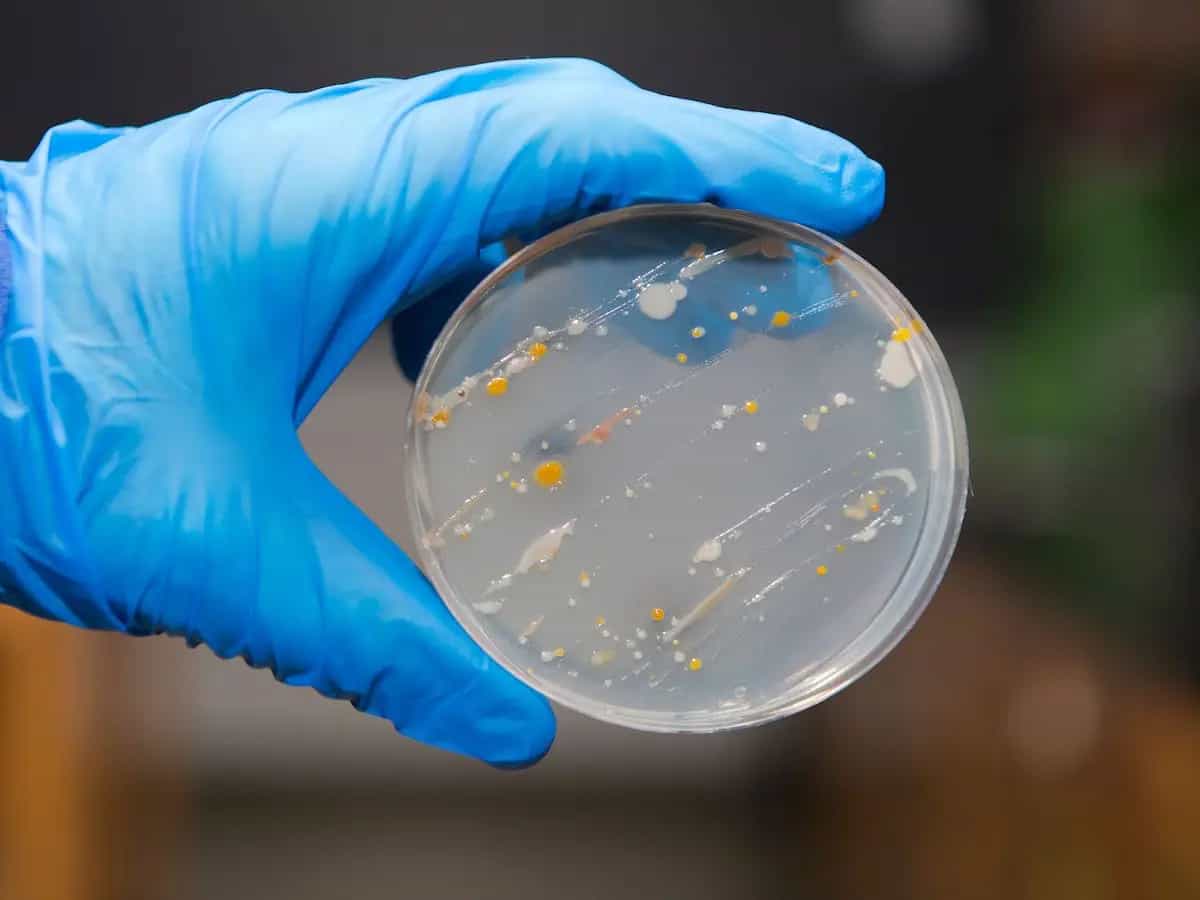 Microplastiche: uno studio rivela il legame con alcuni problemi di salute