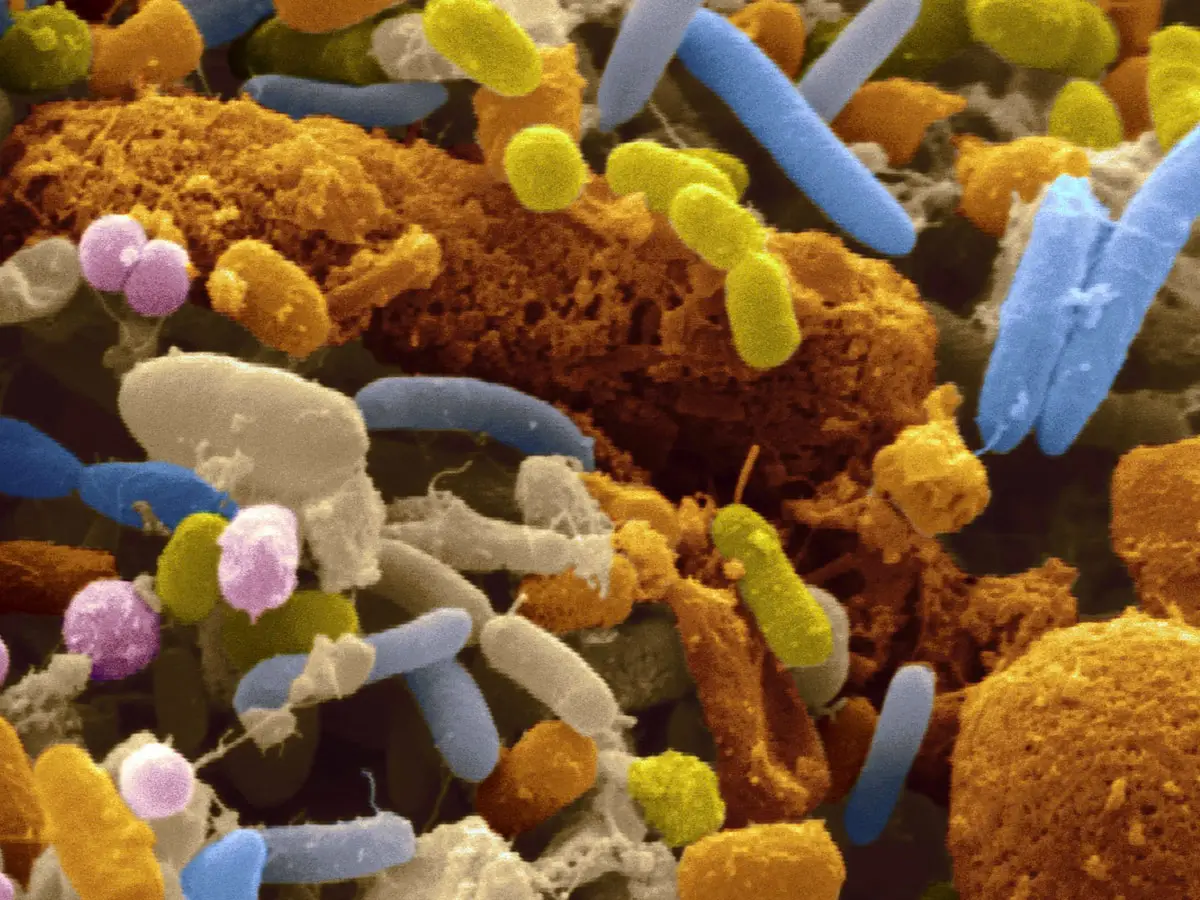 Esta tu intestino lleno de bacterias OMG