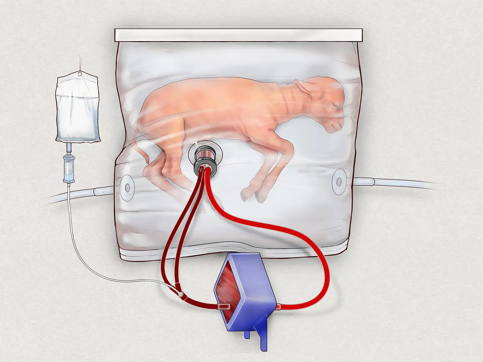 Un utero artificiale per agnellini potrebbe salvare i bambini prematuri