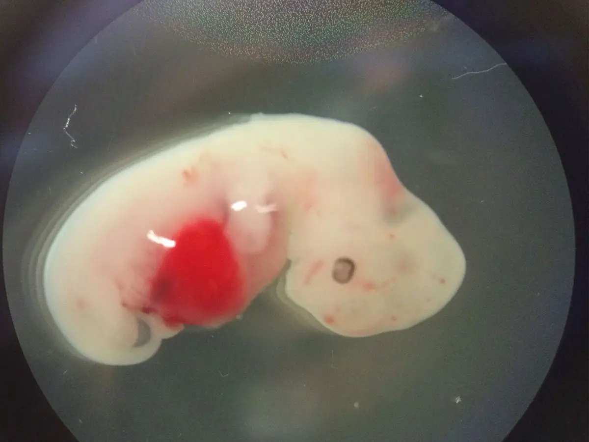 A cosa servono gli embrioni ibridi umano-pecora